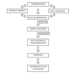 Fatty Liver Disease with Hypertension