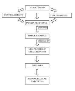 Fatty Liver Disease with Hypertension