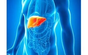 Metabolic dysfunction-Associated Steatotic Liver Disease