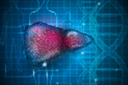 Metabolic dysfunction-Associated Steatotic Liver Disease